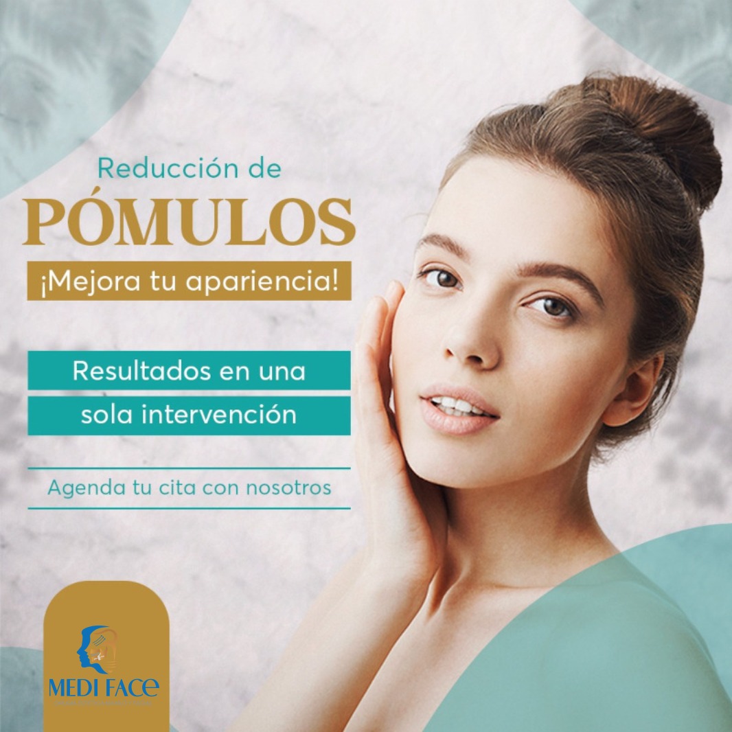 servicio