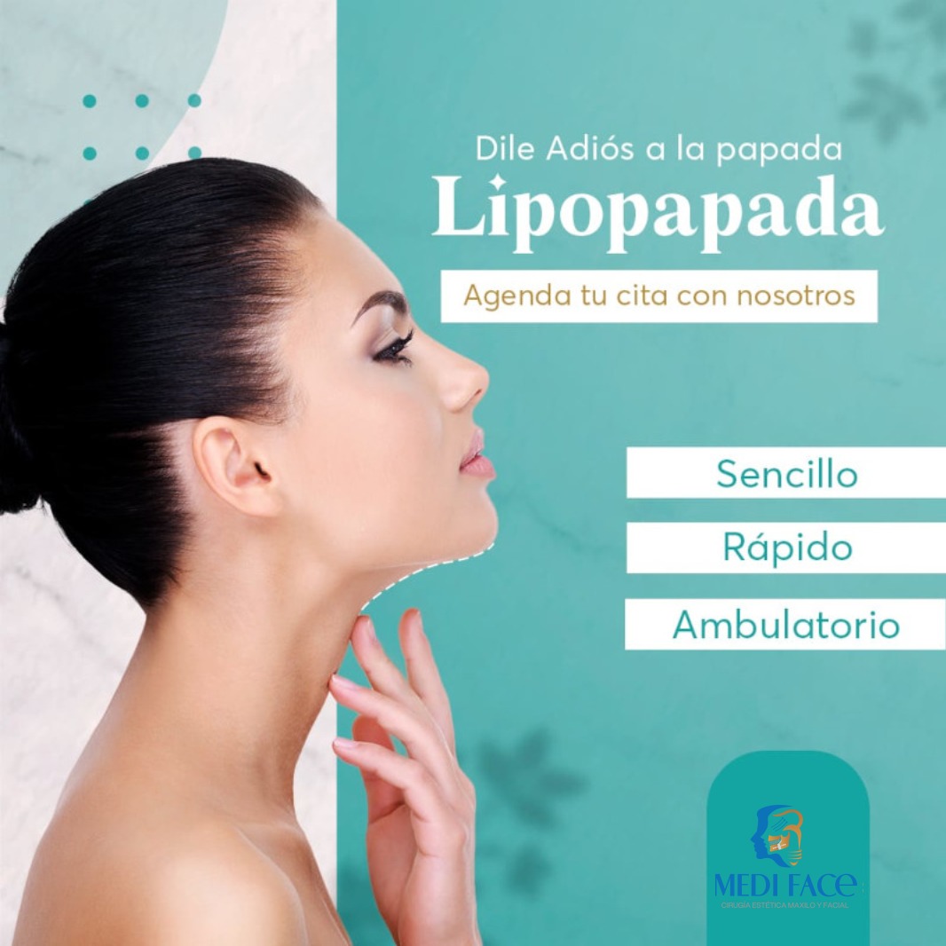 servicio