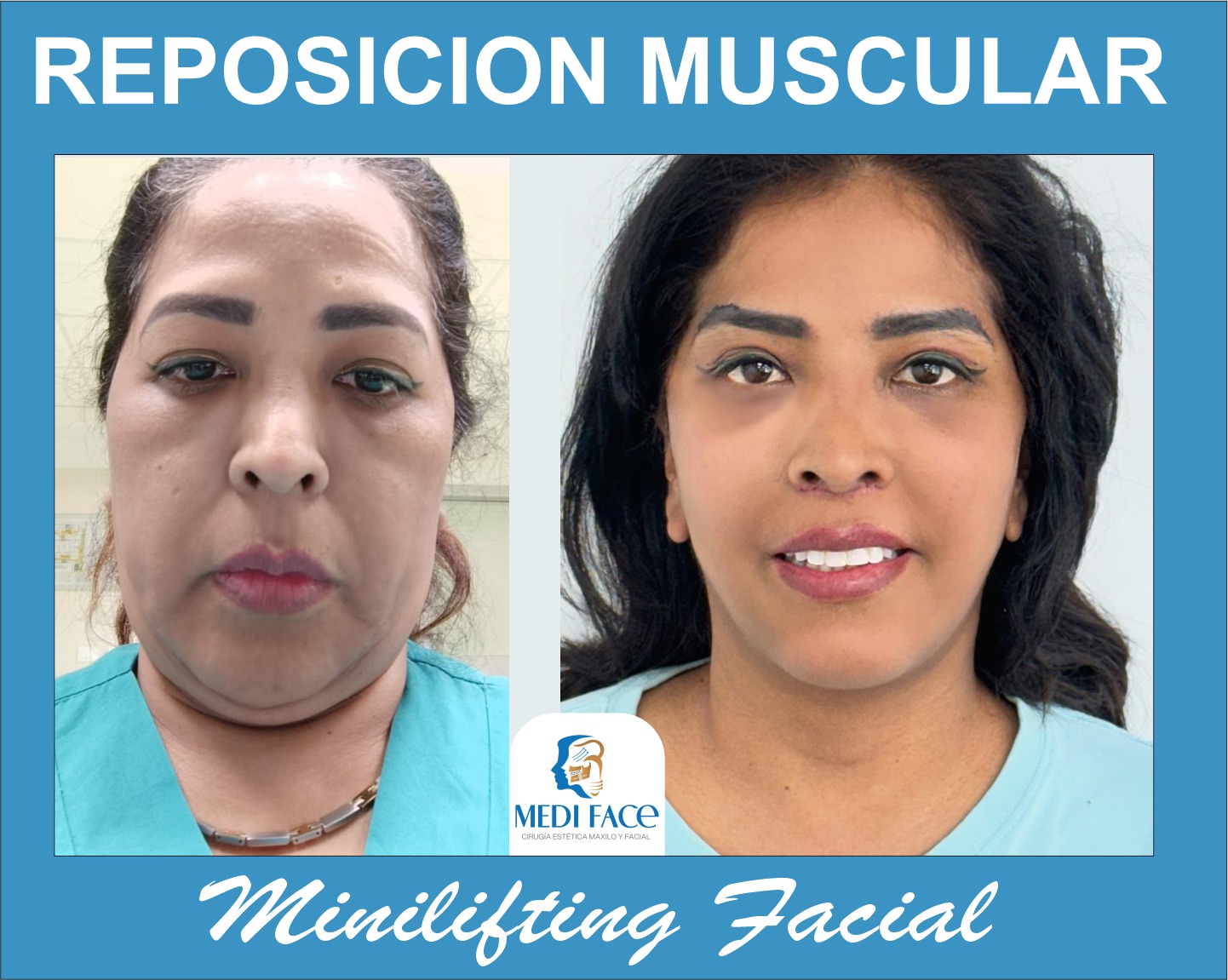 especialidad